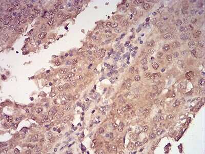 Immunohistochemistry: 14-3-3 beta/alpha Antibody (5B5G10) - BSA Free [NBP2-61780]