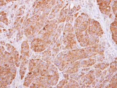 Immunohistochemistry-Paraffin: 14-3-3 beta/alpha Antibody [NBP1-33454]