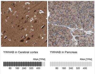 Immunohistochemistry-Paraffin: 14-3-3 beta/alpha Antibody [NBP1-80611]