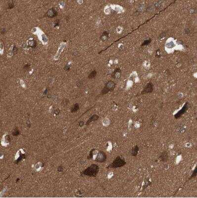 Immunohistochemistry-Paraffin: 14-3-3 beta/alpha Antibody [NBP1-80611]