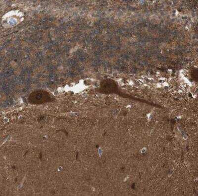 Immunohistochemistry-Paraffin: 14-3-3 beta/alpha Antibody [NBP1-80611]