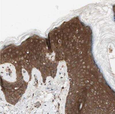 Immunohistochemistry-Paraffin: 14-3-3 beta/alpha Antibody [NBP1-80611]