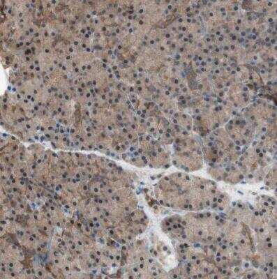 Immunohistochemistry-Paraffin: 14-3-3 beta/alpha Antibody [NBP1-80611]