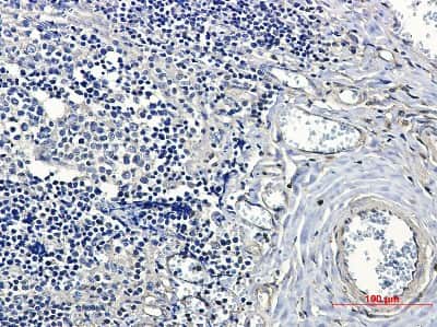 Immunohistochemistry: 14-3-3 beta/alpha Antibody (S08-4A7) [NBP3-14906]