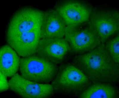 Immunocytochemistry/ Immunofluorescence: 14-3-3 beta/alpha Antibody (SD0837) [NBP2-67833]