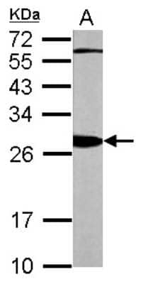 Western Blot: 14-3-3 beta/alpha Antibody [NBP1-33454]