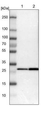 Western Blot: 14-3-3 beta/alpha Antibody [NBP1-80611]