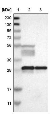 Western Blot: 14-3-3 beta/alpha Antibody [NBP1-80611]