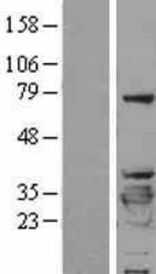 Western Blot: 14-3-3 beta/alpha Overexpression Lysate [NBL1-17946]