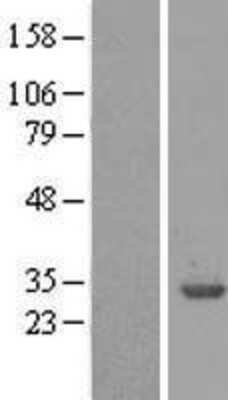 Western Blot: 14-3-3 beta/alpha Overexpression Lysate [NBL1-17947]