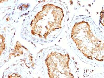 Immunohistochemistry-Paraffin: 14-3-3 epsilon Antibody (CPTC-YWHAE-1) - Azide and BSA Free [NBP2-79944]