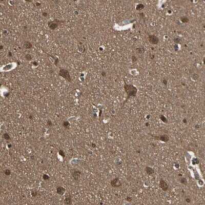 Immunohistochemistry-Paraffin: 14-3-3 epsilon Antibody [NBP1-89827]