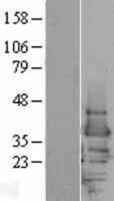 Western Blot: 14-3-3 epsilon Overexpression Lysate [NBP2-04318]