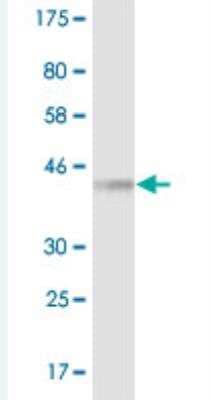 Western Blot: 14-3-3 eta Antibody (1C2) [H00007533-M07]