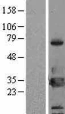 Western Blot: 14-3-3 eta Overexpression Lysate [NBL1-17950]