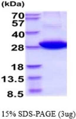 SDS-PAGE: Recombinant Human 14-3-3 eta Protein [NBP2-52347]