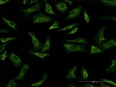 Immunocytochemistry/ Immunofluorescence: 14-3-3 gamma Antibody (1B4) [H00007532-M03]