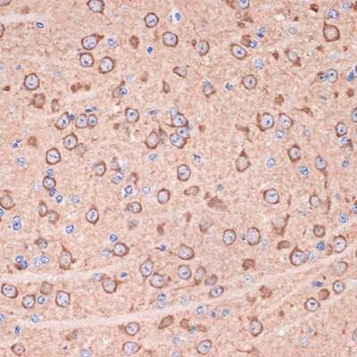 Immunohistochemistry-Paraffin: 14-3-3 gamma Antibody (5R4Q4) [NBP3-16771]