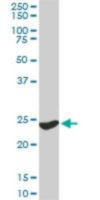 Western Blot: 14-3-3 gamma Antibody (6A10) [H00007532-M02]