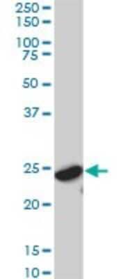 Western Blot: 14-3-3 gamma Antibody (6A10) [H00007532-M02]