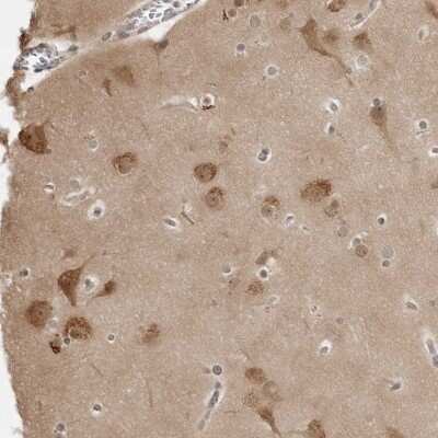 Immunohistochemistry-Paraffin: 14-3-3 gamma Antibody [NBP2-54679]