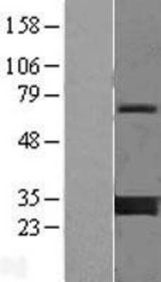 Western Blot: 14-3-3 gamma Overexpression Lysate [NBL1-17949]