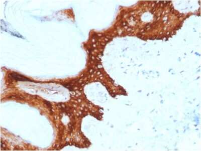 Immunohistochemistry-Paraffin: 14-3-3 sigma/Stratifin Antibody (CPTC-SFN-2) [NBP3-07326]