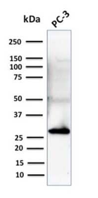 Western Blot: 14-3-3 sigma/Stratifin Antibody (CPTC-SFN-2) [NBP3-07326]