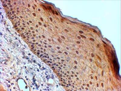 Immunohistochemistry-Paraffin: 14-3-3 sigma/Stratifin Antibody [NB100-2465]