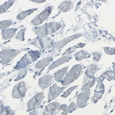 Immunohistochemistry-Paraffin: 14-3-3 sigma/Stratifin Antibody [NBP1-80610]