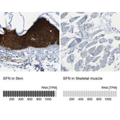 Immunohistochemistry-Paraffin: 14-3-3 sigma/Stratifin Antibody [NBP1-80610]