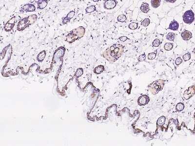 Immunohistochemistry-Paraffin: 14-3-3 sigma/Stratifin Antibody [NBP2-98309]