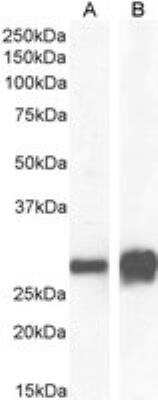 Western Blot: 14-3-3 sigma/Stratifin Antibody [NB100-2465]