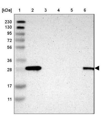 Western Blot: 14-3-3 sigma/Stratifin Antibody [NBP1-80610]