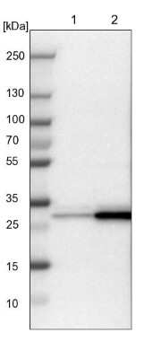 Western Blot: 14-3-3 sigma/Stratifin Antibody [NBP1-80610]