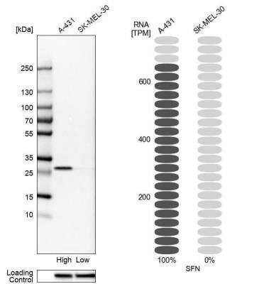 Western Blot: 14-3-3 sigma/Stratifin Antibody [NBP1-80610]