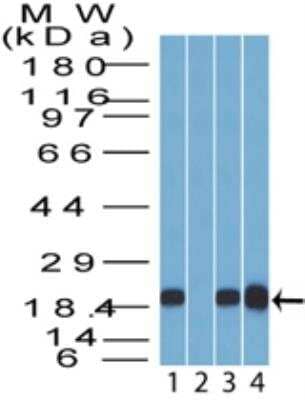 Western Blot: 14-3-3 sigma/Stratifin Antibody [NBP2-27072]