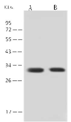 Western Blot: 14-3-3 sigma/Stratifin Antibody [NBP2-98309]