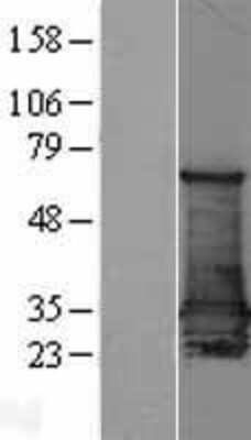 Western Blot: 14-3-3 sigma/Stratifin Overexpression Lysate [NBL1-15882]