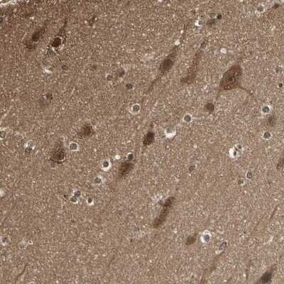 Immunohistochemistry-Paraffin: 14-3-3 tau/theta Antibody [NBP1-90337]