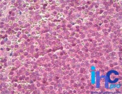Immunohistochemistry-Paraffin: 14-3-3 zeta Antibody [NBP2-24593]