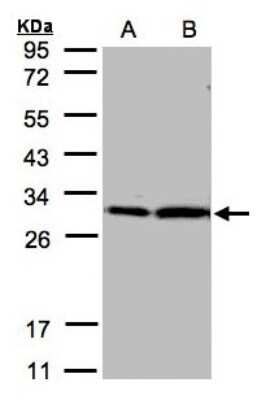 Western Blot: 14-3-3 zeta Antibody [NBP1-31325]