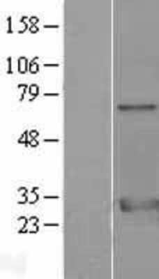 Western Blot: 14-3-3 zeta Overexpression Lysate [NBL1-17952]