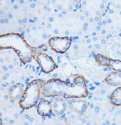 Immunohistochemistry-Paraffin: 14-3-3 zeta/delta Antibody - Azide and BSA Free [NBP2-92813]