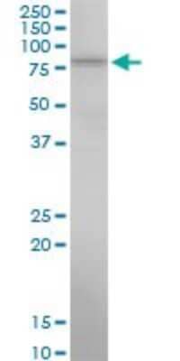 Western Blot: 15-Lipoxygenase 1 Antibody (1A11) [H00000246-M07]