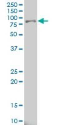 Western Blot: 15-Lipoxygenase 1 Antibody (3D8) [H00000246-M04]