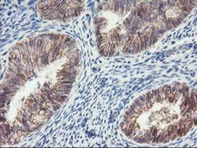 Immunohistochemistry-Paraffin: 15-Lipoxygenase 1 Antibody (OTI3G8) [NBP2-01740]
