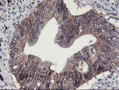 Immunohistochemistry-Paraffin: 15-Lipoxygenase 1 Antibody (OTI3G8) [NBP2-01740]