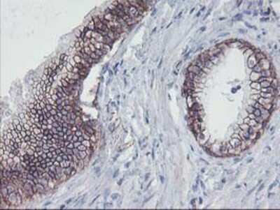 Immunohistochemistry-Paraffin: 15-Lipoxygenase 1 Antibody (OTI3G8) [NBP2-01740]