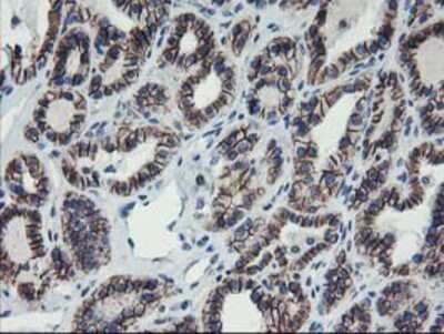 Immunohistochemistry-Paraffin: 15-Lipoxygenase 1 Antibody (OTI3G8) [NBP2-01740]